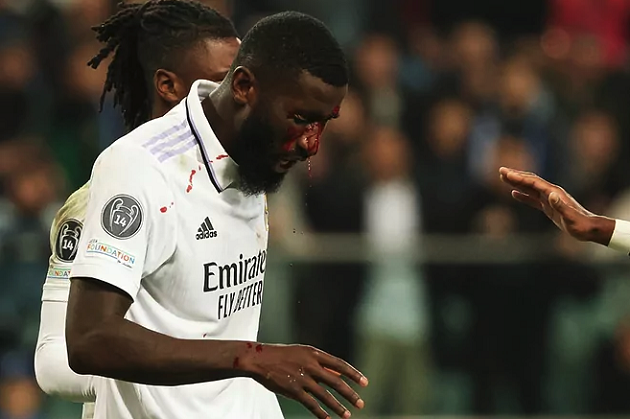 3 sự thật ở Champions League sau loạt trận đêm thứ ba