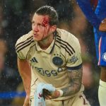 Weghorst chảy máu đầm đìa trận gặp Chelsea